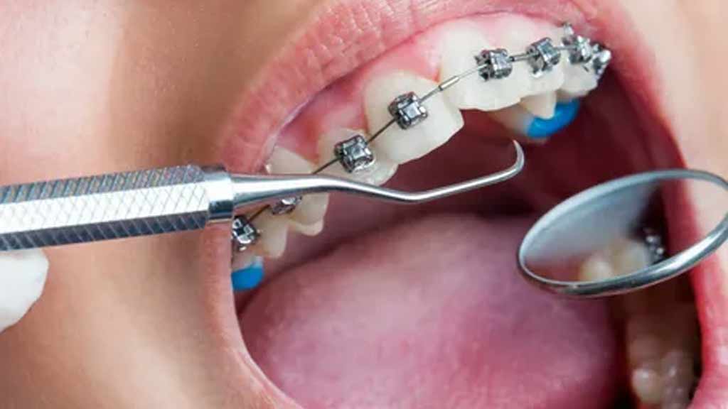 ارتودنسی دندان در شیراز