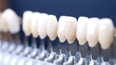 قیمت کامپوزیت دندان در شیراز⭐️【آپدیت1403】