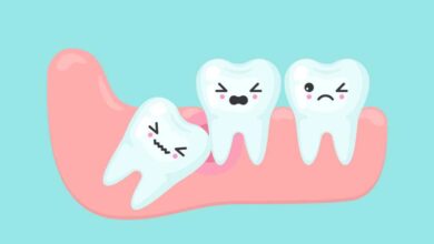 دندانپزشک جراحی دندان نهفته در شیراز ⭐️【آپدیت1403】