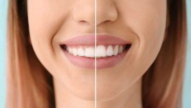 بهترین دندانپزشک جراحی لثه در شیراز