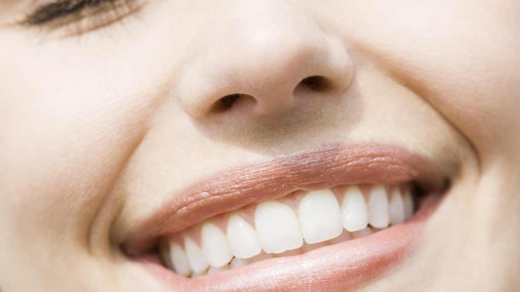 دندانپزشک فیسینگ دندان در شیراز