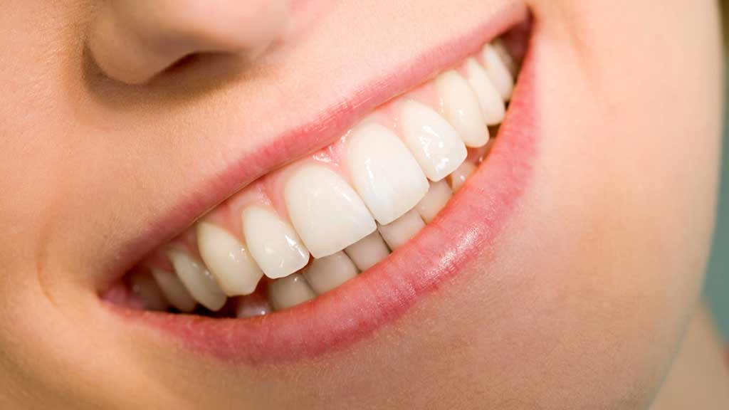 دندانپزشک فیسینگ دندان در شیراز