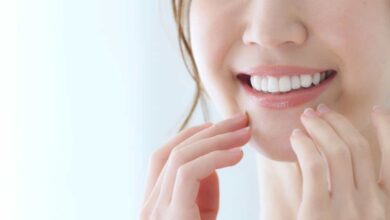 دندانپزشک فیسینگ دندان در شیراز