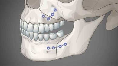 بهترین متخصص جراحی فک در شیراز ⭐ [1403]
