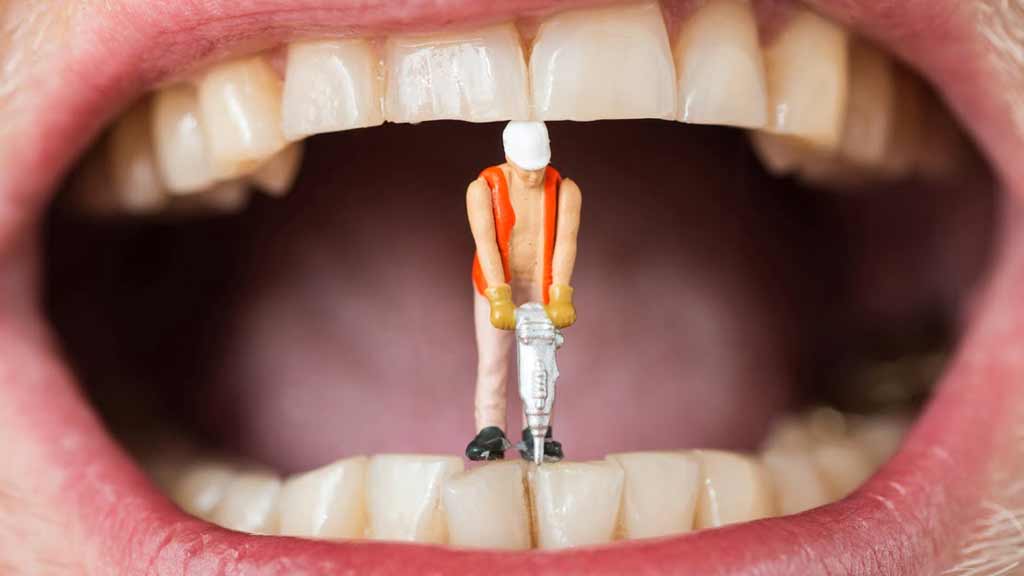 دندانپزشک پر کردن دندان در شیراز⭐️【آپدیت1403】