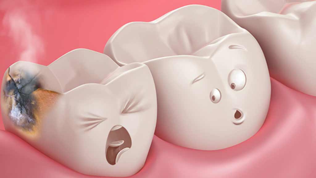 دندانپزشک پر کردن دندان در شیراز⭐️【آپدیت1403】