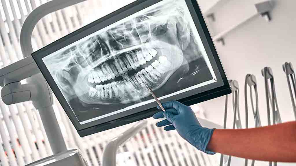 معرفی بهترین متخصص رادیولوژی دهان و دندان در شیراز ⭐️【آپدیت1403】