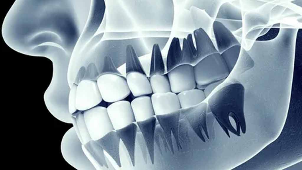 بهترین دندانپزشکی دیجیتال در شیراز ⭐ [1403]