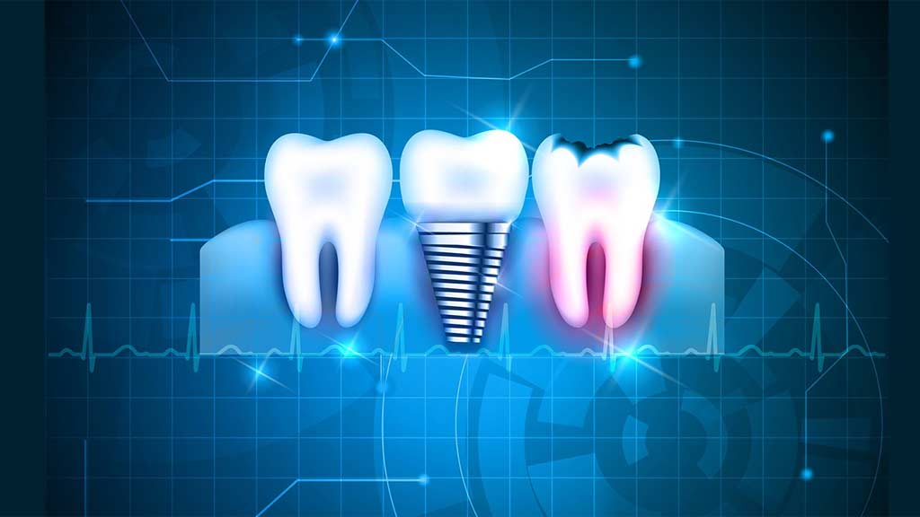 بهترین دندانپزشکی دیجیتال در شیراز ⭐ [1403]
