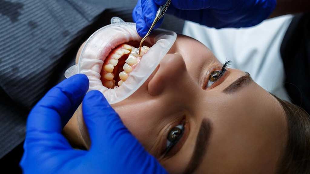 بهترین دندانپزشک متخصص جراحی دندان عقل در شیراز