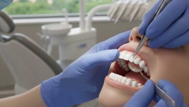 روکش دندان در صدرا