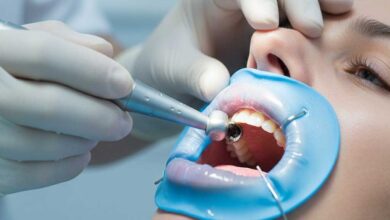 پر کردن دندان در صدرا